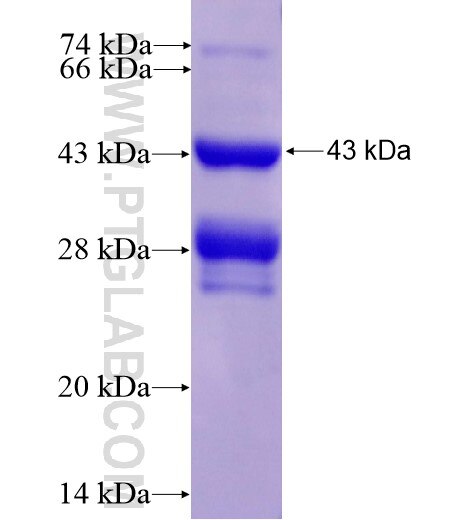 SLC38A9 fusion protein Ag15607 SDS-PAGE