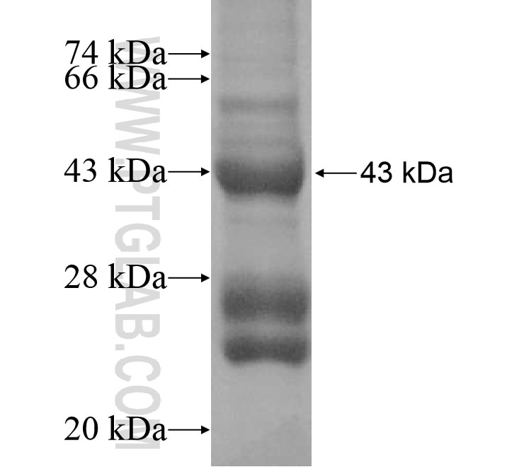 SLC38A9 fusion protein Ag16174 SDS-PAGE