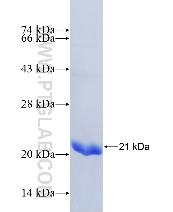 SLC38A9 fusion protein Ag17004 SDS-PAGE