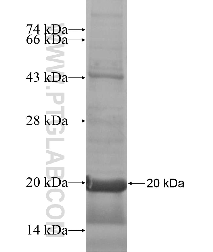 SLC38A9 fusion protein Ag17147 SDS-PAGE
