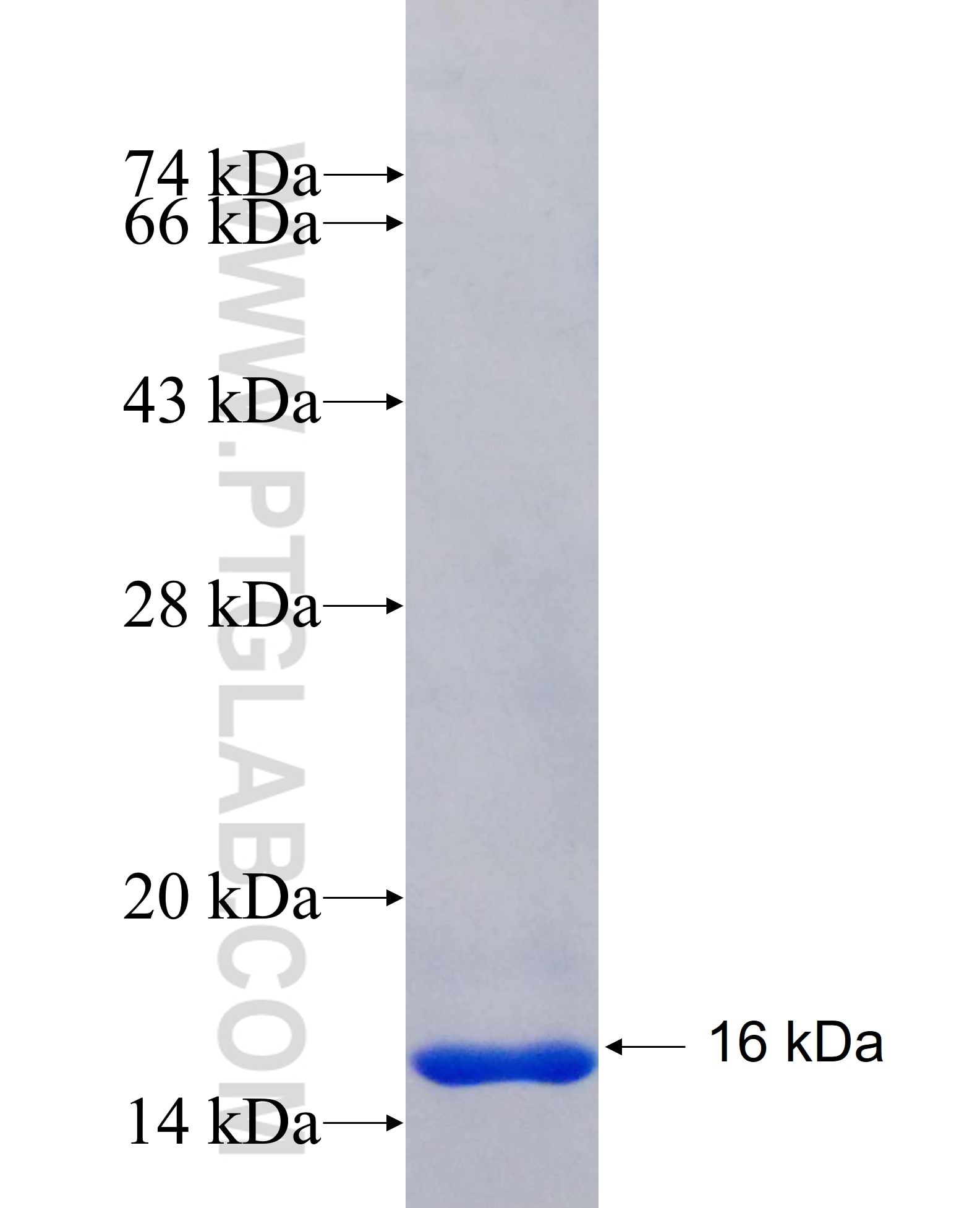 SLC39A1 fusion protein Ag25179 SDS-PAGE