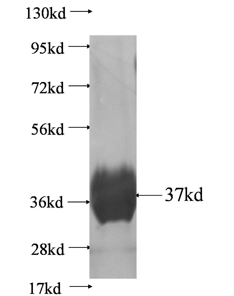 SLC39A1 fusion protein Ag0993 SDS-PAGE