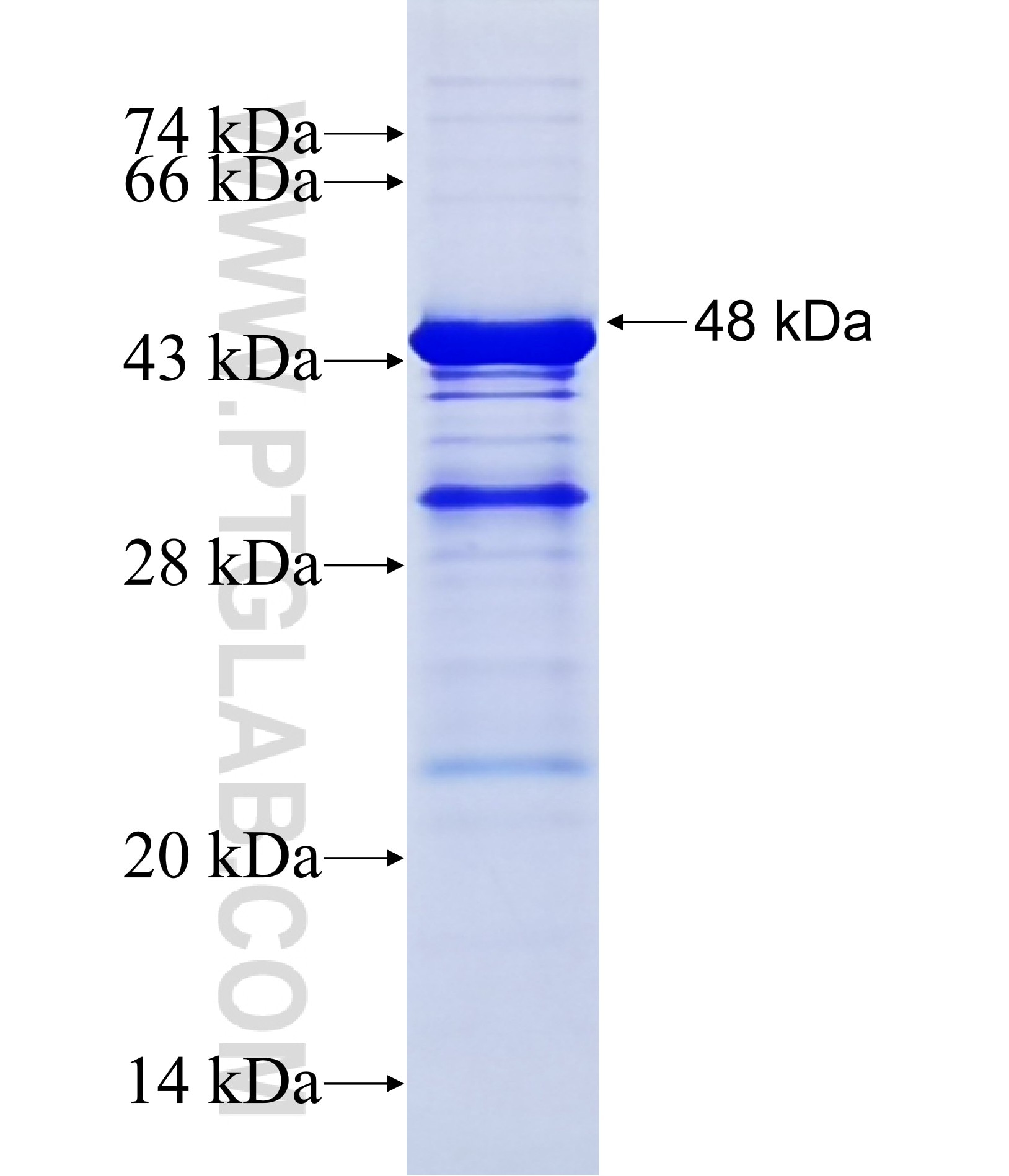 SLC39A10 fusion protein Ag20243 SDS-PAGE SLC39A10 fusion protein Ag20243 SDS-PAGE