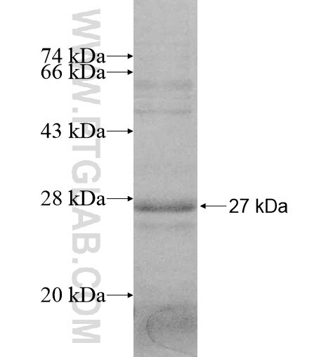 SLC39A11 fusion protein Ag11115 SDS-PAGE SLC39A11 fusion protein Ag11115 SDS-PAGE