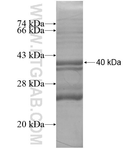 SLC39A11 fusion protein Ag14541 SDS-PAGE