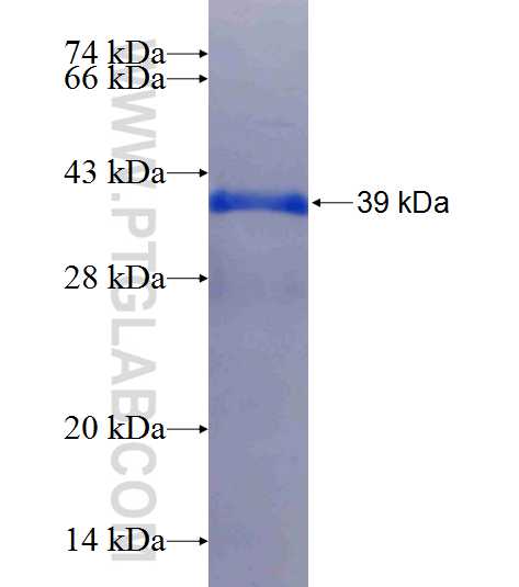 SLC39A14 fusion protein Ag24210 SDS-PAGE