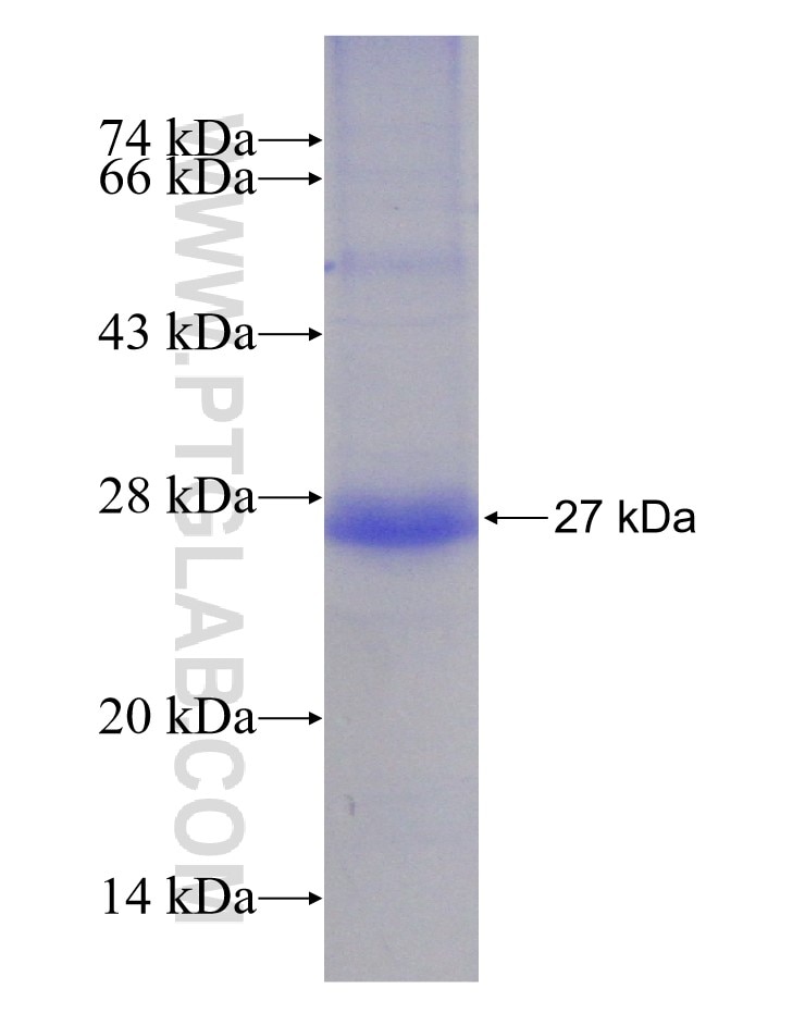 SLC39A14 fusion protein Ag14817 SDS-PAGE