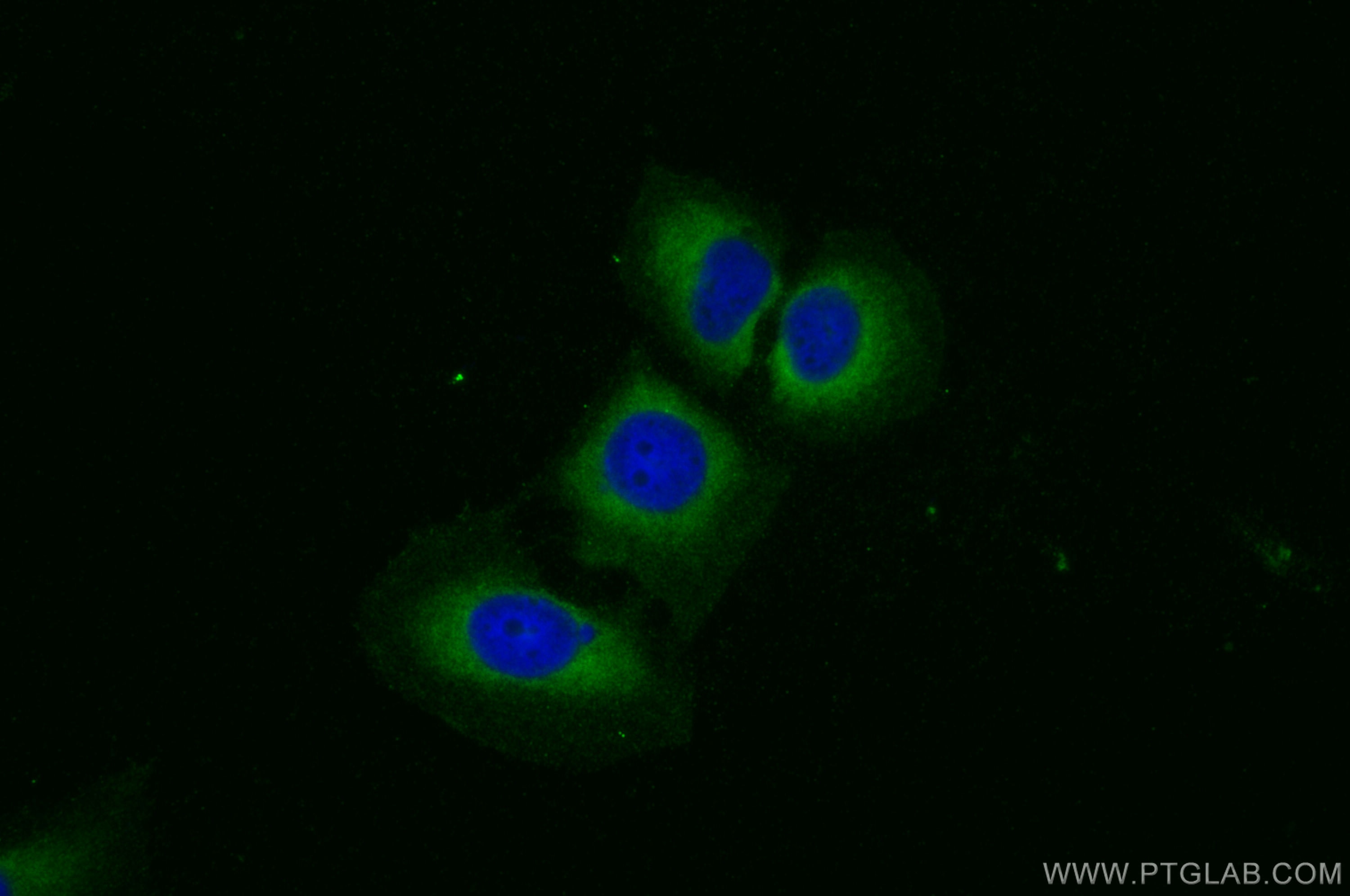 Immunofluorescence (IF) / fluorescent staining of U2OS cells using SLC39A14/ZIP-14 Polyclonal antibody (26540-1-AP)