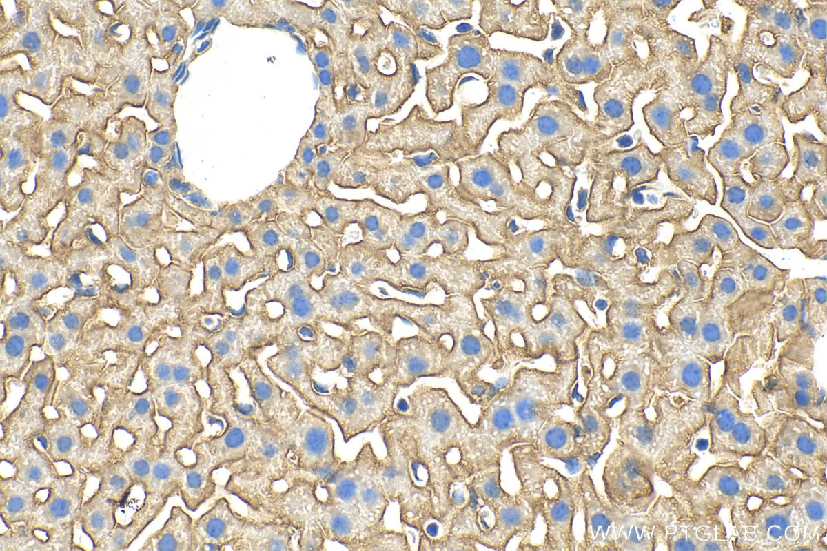Immunohistochemistry (IHC) staining of mouse liver tissue using SLC39A14/ZIP-14 Polyclonal antibody (26540-1-AP)