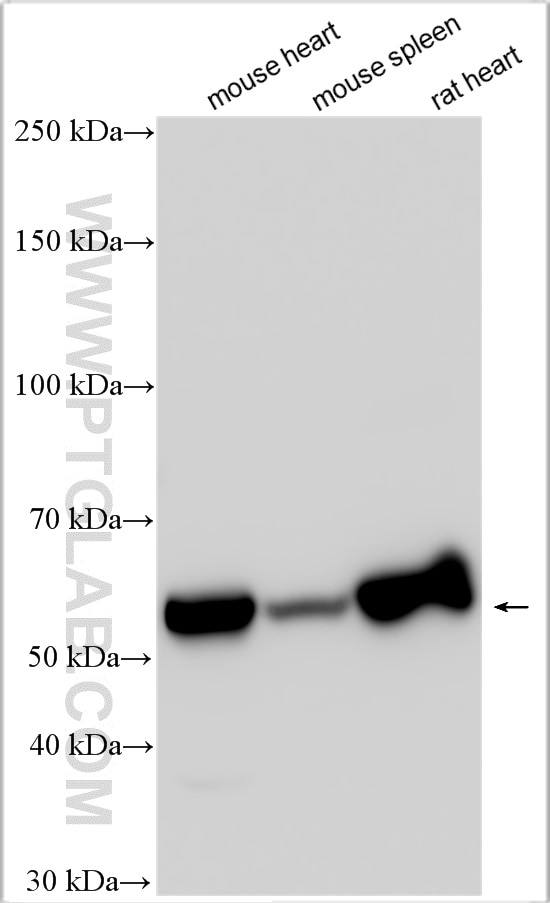 Western Blot (WB) analysis of various lysates using SLC39A14/ZIP-14 Polyclonal antibody (26540-1-AP)