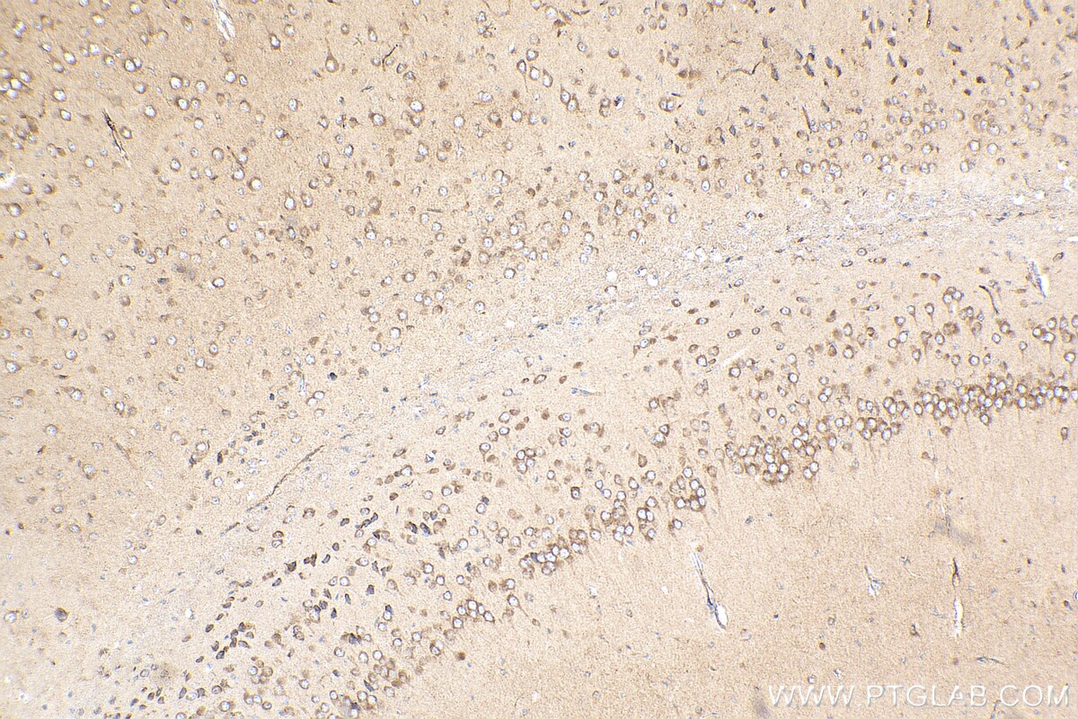 Immunohistochemistry (IHC) staining of mouse brain tissue using SLC39A2 Polyclonal antibody (21287-1-AP)