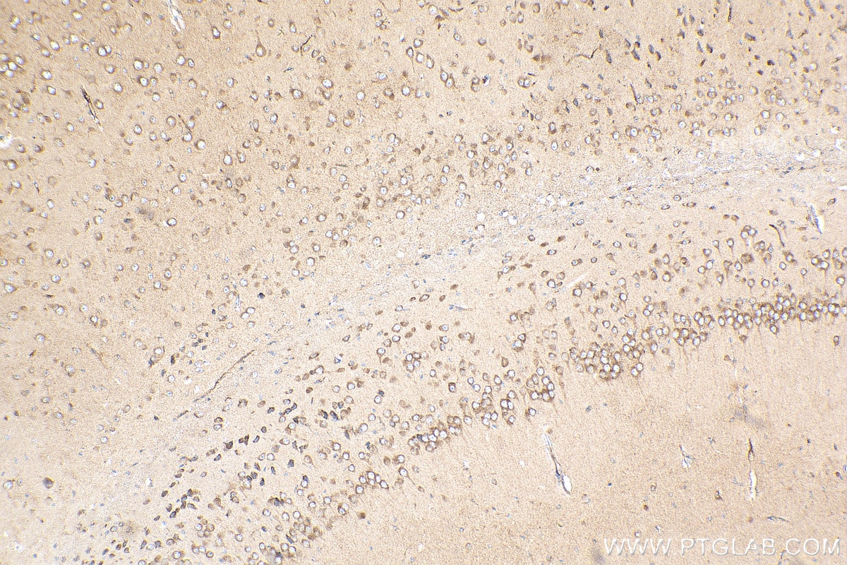 Immunohistochemistry (IHC) staining of mouse brain tissue using SLC39A2 Polyclonal antibody (21287-1-AP)