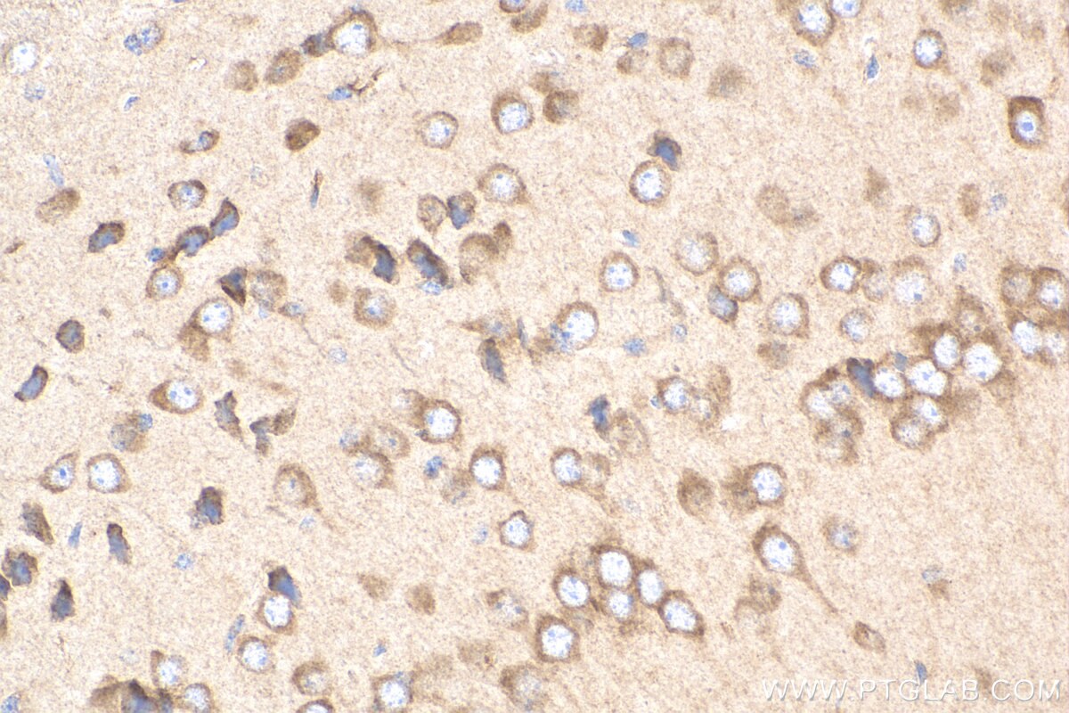 Immunohistochemistry (IHC) staining of mouse brain tissue using SLC39A2 Polyclonal antibody (21287-1-AP)