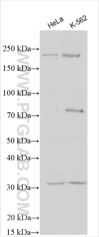 Western Blot (WB) analysis of various lysates using SLC39A2 Polyclonal antibody (21287-1-AP)