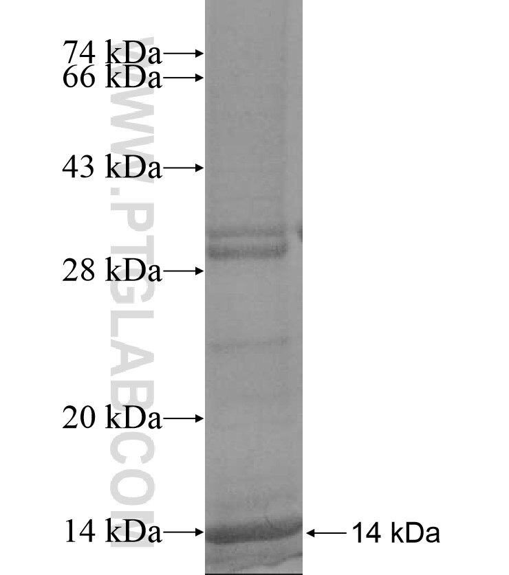 SLC39A2 fusion protein Ag16981 SDS-PAGE