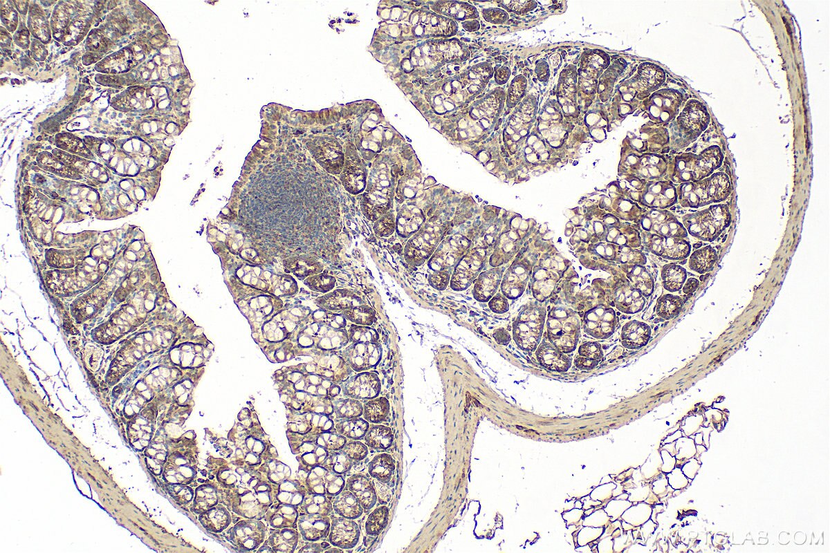 Immunohistochemistry (IHC) staining of mouse colon tissue using SLC39A3 Polyclonal antibody (20458-1-AP)