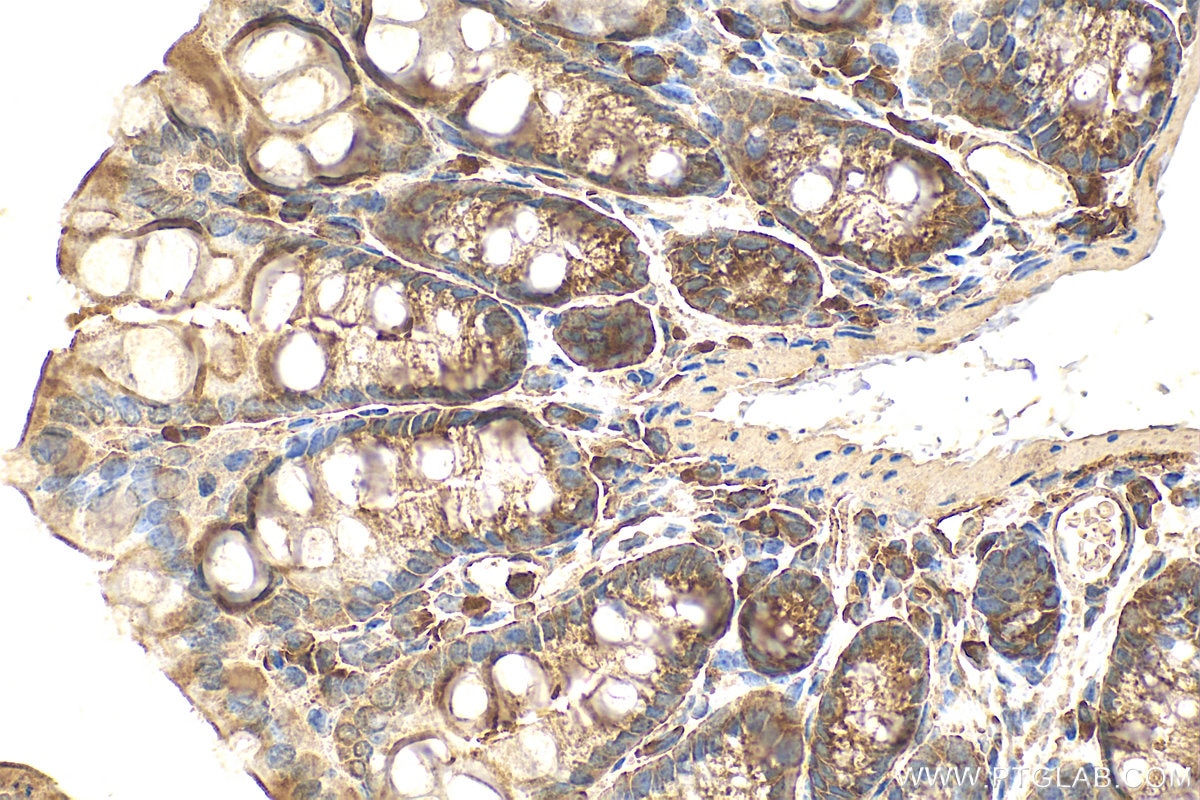Immunohistochemistry (IHC) staining of mouse colon tissue using SLC39A3 Polyclonal antibody (20458-1-AP)