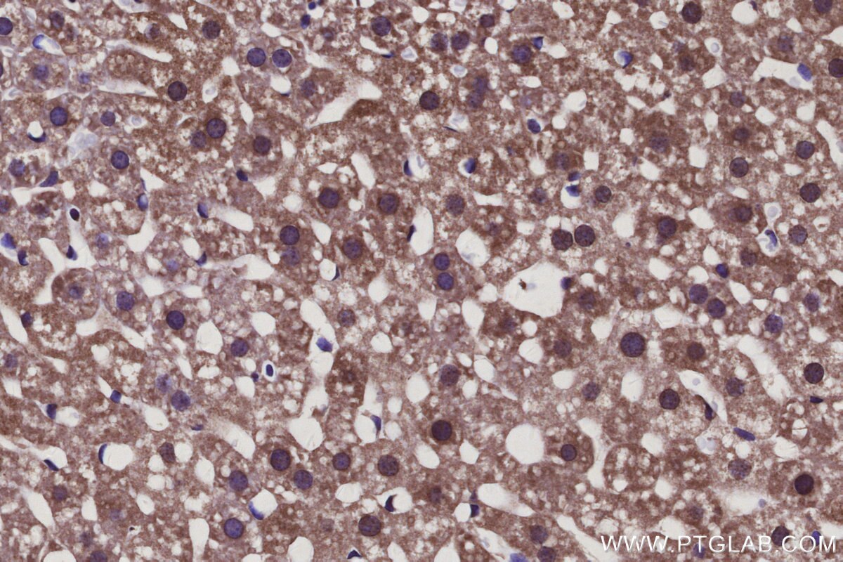 IHC staining of mouse liver using 20458-1-AP Immunohistochemistry (IHC) staining of mouse liver tissue using SLC39A3 Polyclonal antibody (20458-1-AP)