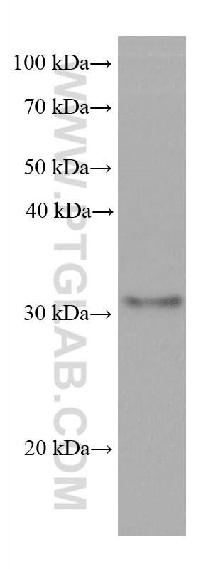 Western Blot (WB) analysis of LNCaP cells using SLC39A3 Monoclonal antibody (68025-1-Ig)