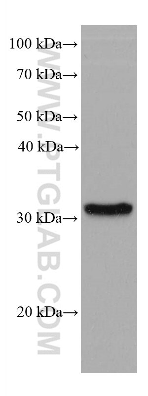 Western Blot (WB) analysis of Jurkat cells using SLC39A3 Monoclonal antibody (68025-1-Ig)