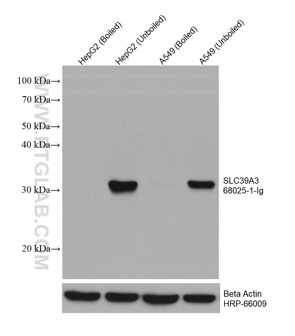 Western Blot (WB) analysis of various lysates using SLC39A3 Monoclonal antibody (68025-1-Ig)