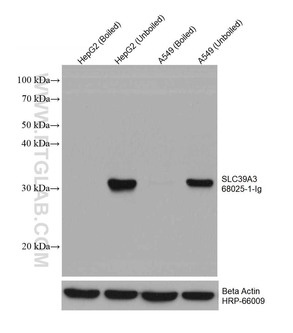 WB analysis using 68025-1-Ig