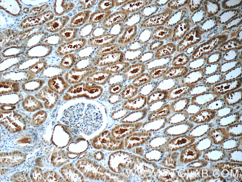 Immunohistochemistry (IHC) staining of human kidney tissue using ZIP4 Polyclonal antibody (20625-1-AP)