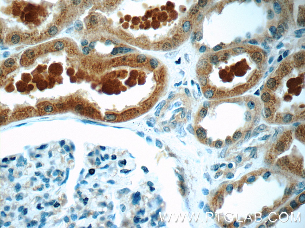 Immunohistochemistry (IHC) staining of human kidney tissue using ZIP4 Polyclonal antibody (20625-1-AP)
