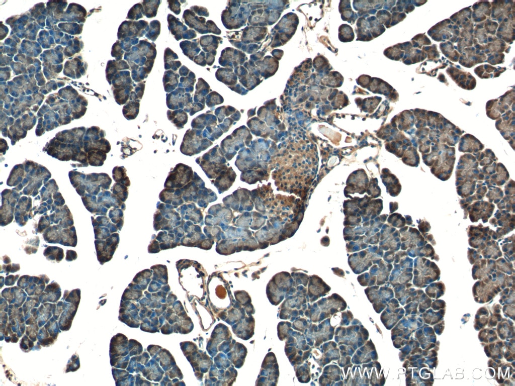 IHC staining of mouse pancreas using 20625-1-AP