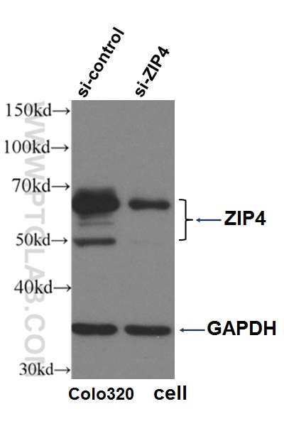Western Blot (WB) analysis of Colo320 cells using ZIP4 Polyclonal antibody (20625-1-AP)