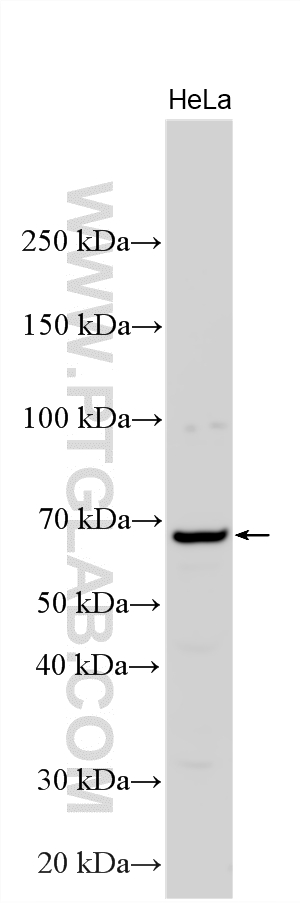Western Blot (WB) analysis of various lysates using ZIP4 Polyclonal antibody (20625-1-AP)