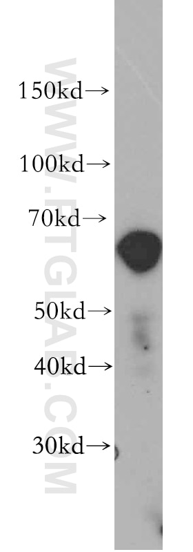 Western Blot (WB) analysis of human jejunum tissue using ZIP4 Polyclonal antibody (20625-1-AP)