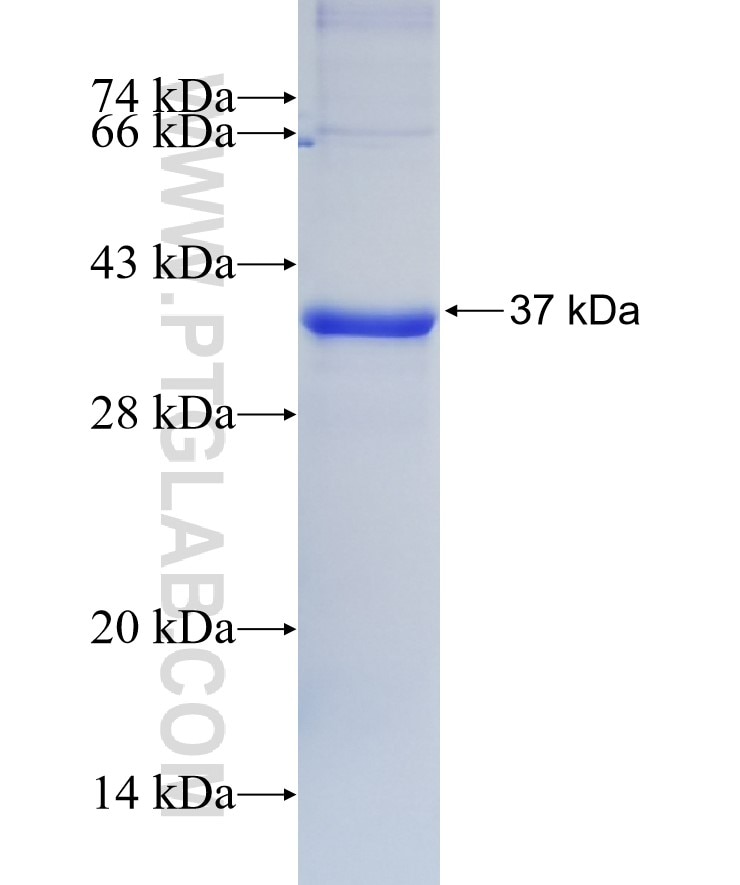 SLC39A4 fusion protein Ag14524 SDS-PAGE