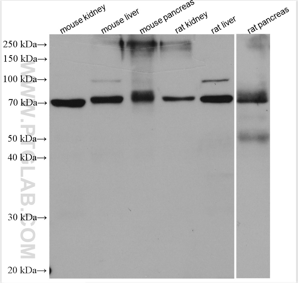 Western Blot (WB) analysis of various lysates using SLC39A5 Polyclonal antibody (17285-1-AP)
