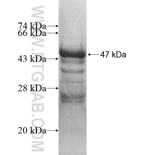 SLC39A5 fusion protein Ag11067 SDS-PAGE