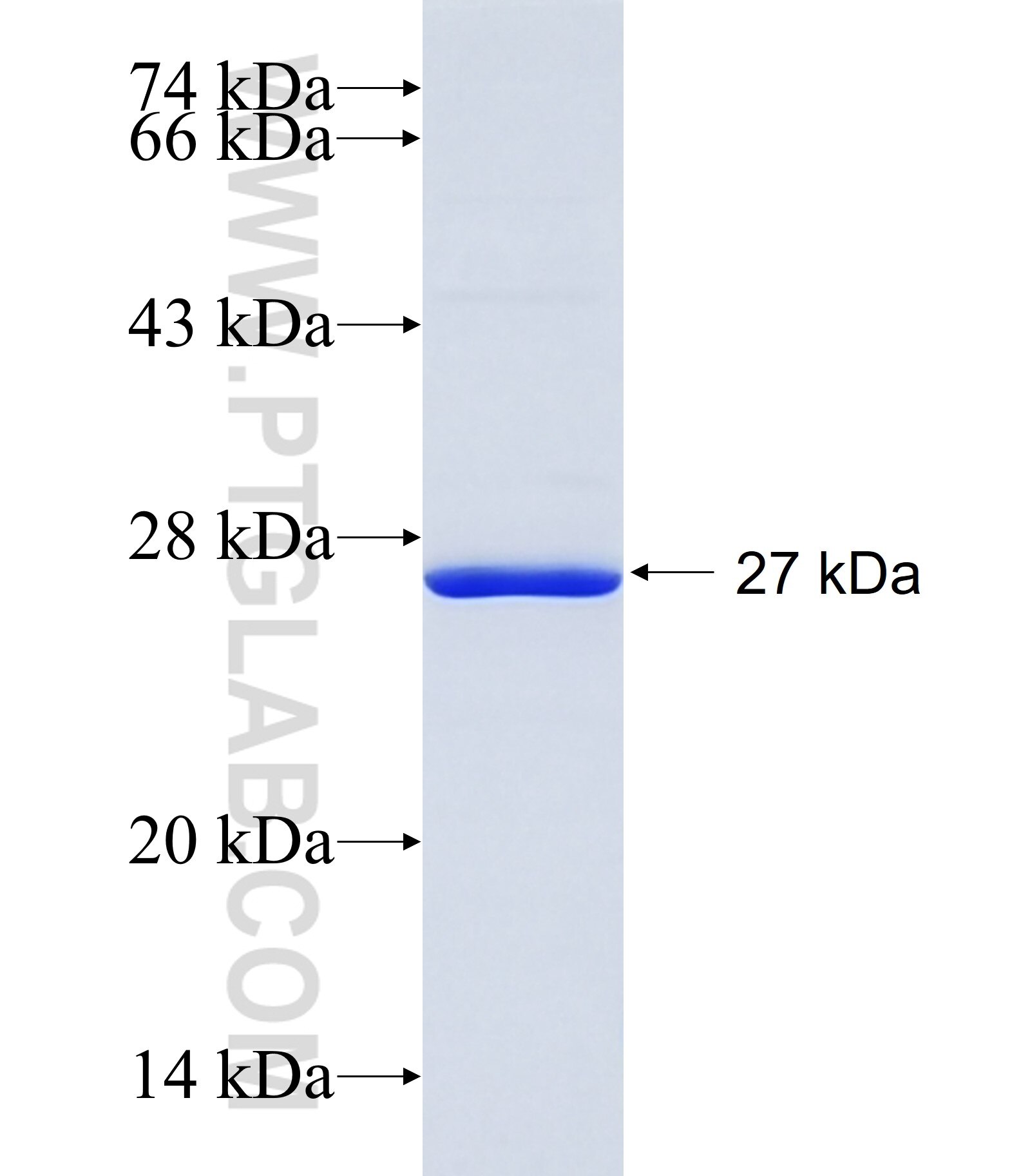 SLC39A5 fusion protein Ag11100 SDS-PAGE