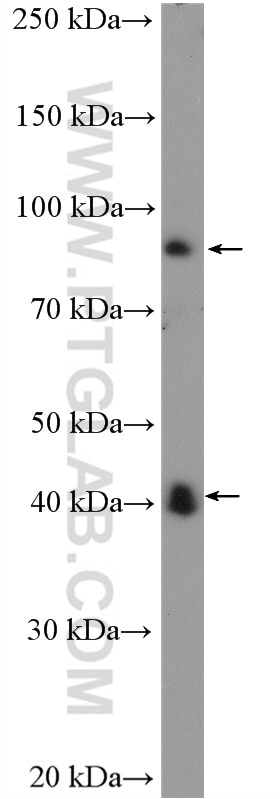 Western Blot (WB) analysis of MCF-7 cells using LIV-1/ZIP6 Polyclonal antibody (14236-1-AP)