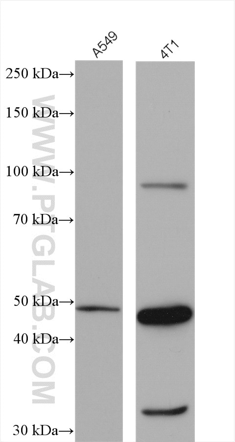 Western Blot (WB) analysis of various lysates using LIV-1/ZIP6 Polyclonal antibody (14236-1-AP)