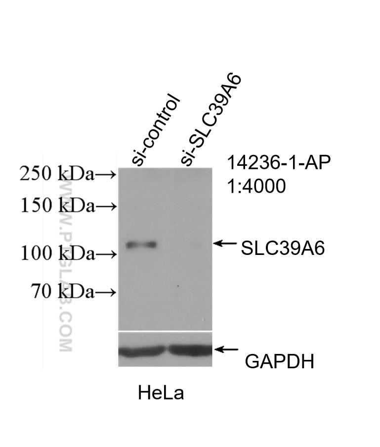 Western Blot (WB) analysis of HeLa cells using LIV-1/ZIP6 Polyclonal antibody (14236-1-AP)