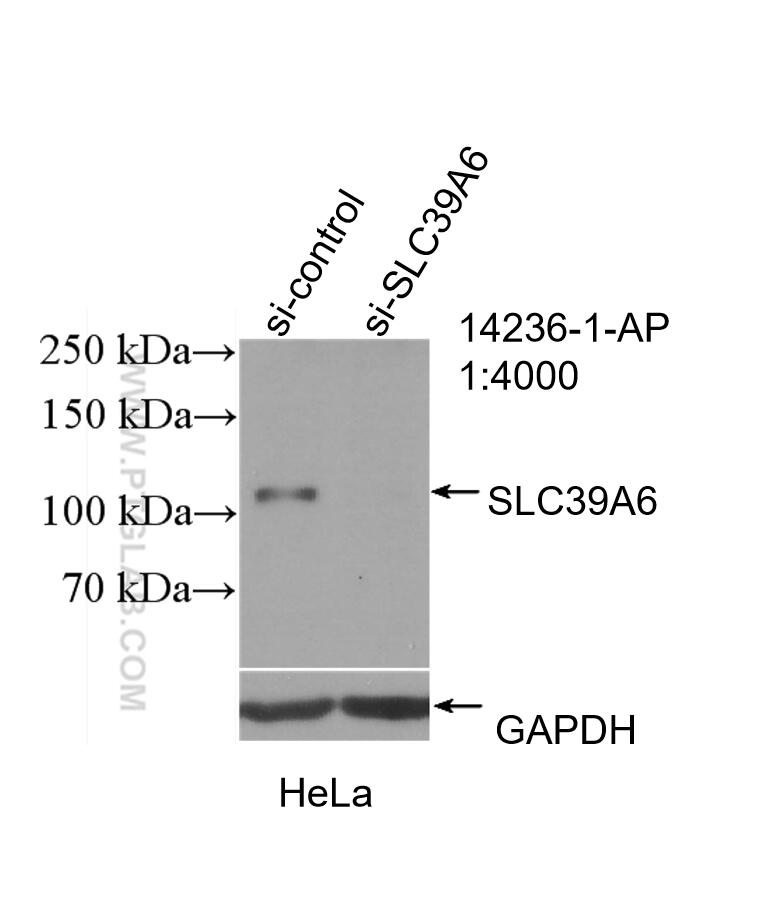 WB analysis of HeLa using 14236-1-AP