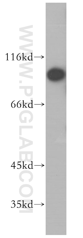 Western Blot (WB) analysis of HeLa cells using LIV-1/ZIP6 Polyclonal antibody (14236-1-AP)