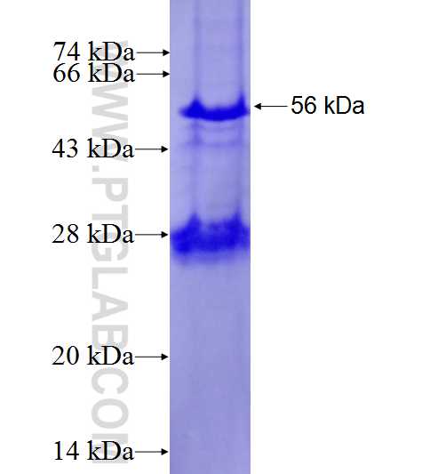 SLC39A6 fusion protein Ag5478 SDS-PAGE