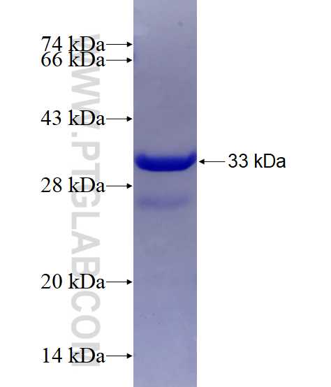 SLC39A6 fusion protein Ag5676 SDS-PAGE