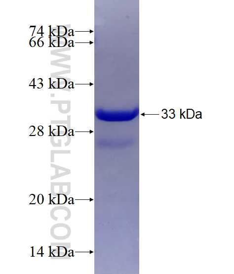 SLC39A6 fusion protein Ag5676 SDS-PAGE