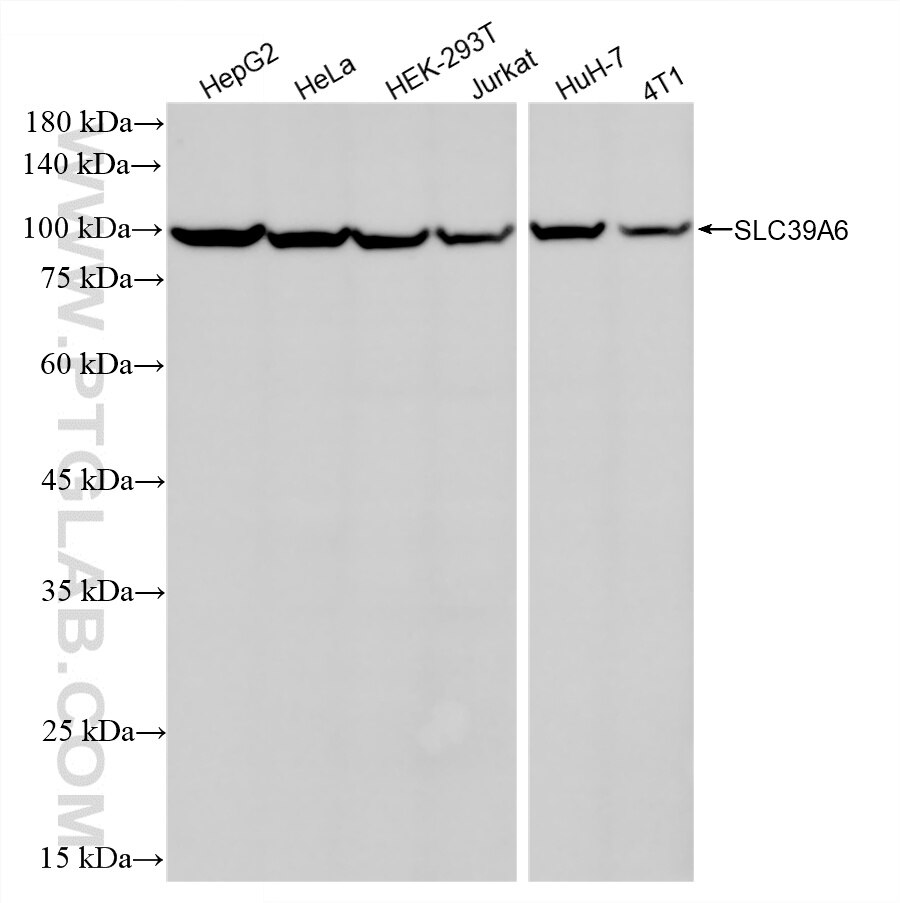 Western Blot (WB) analysis of various lysates using SLC39A6/ZIP6 Recombinant monoclonal antibody (87340-1-RR)