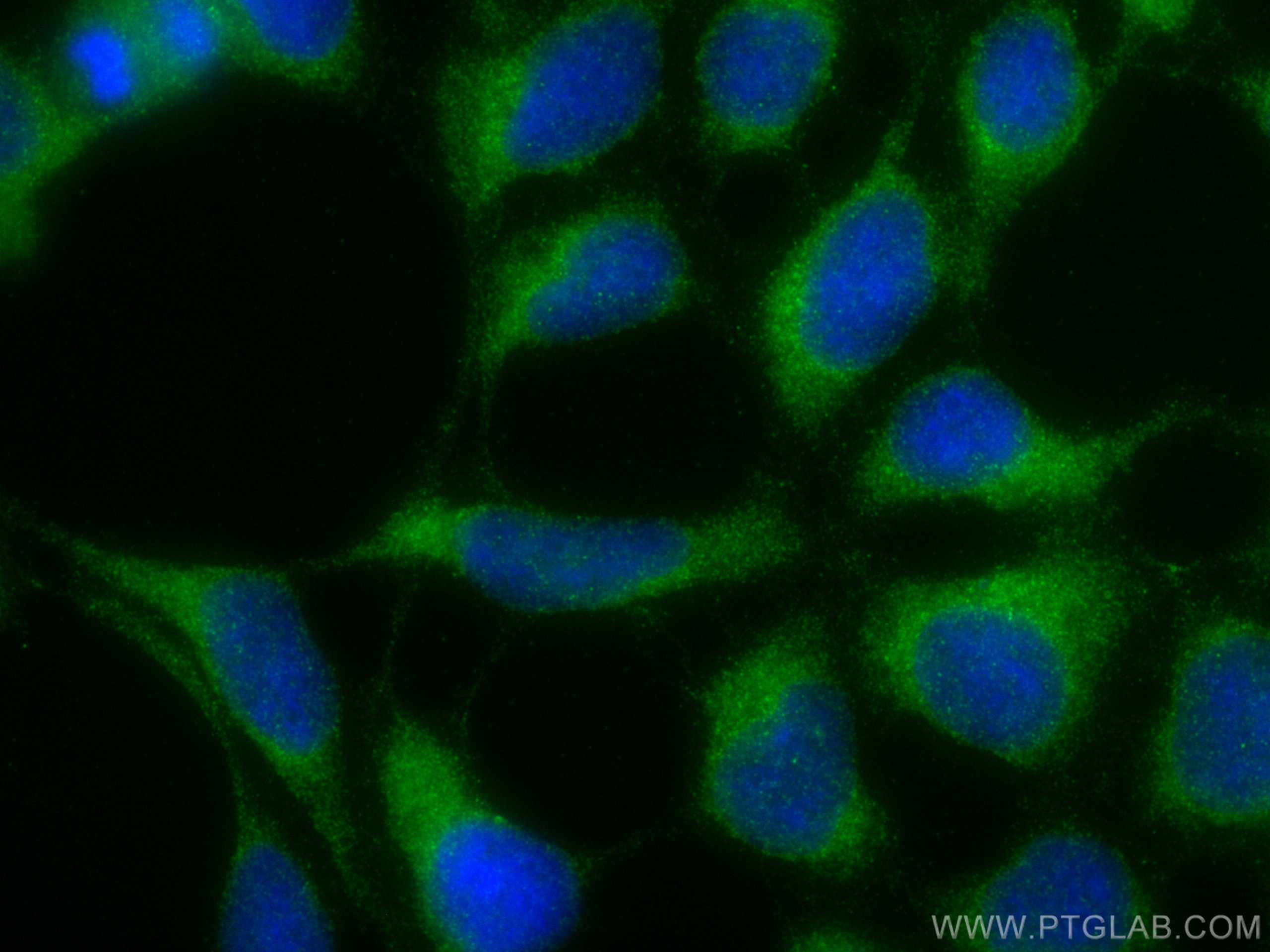Immunofluorescence (IF) / fluorescent staining of HEK-293 cells using ZIP7 Polyclonal antibody (19429-1-AP)