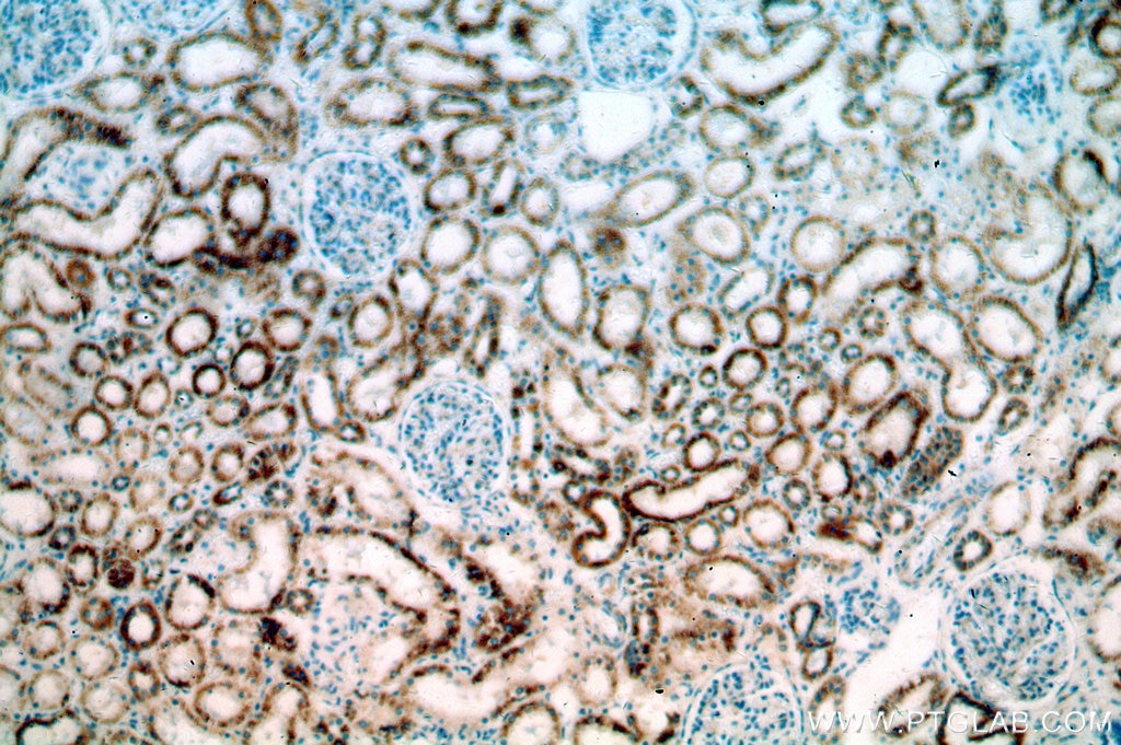 Immunohistochemistry (IHC) staining of human kidney tissue using ZIP7 Polyclonal antibody (19429-1-AP)