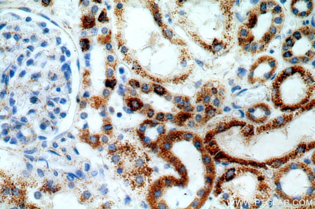 Immunohistochemistry (IHC) staining of human kidney tissue using ZIP7 Polyclonal antibody (19429-1-AP)