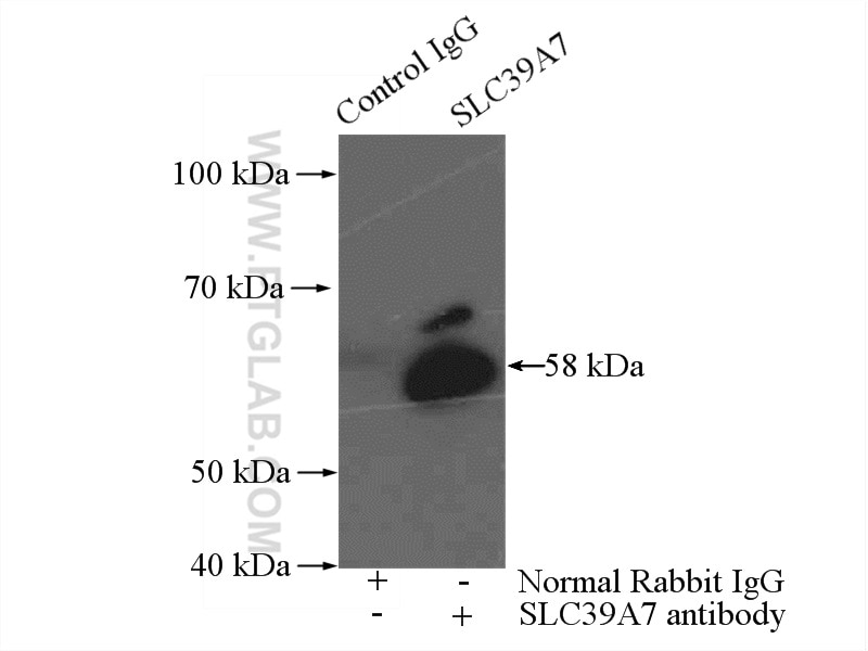 Immunoprecipitation (IP) experiment of mouse brain tissue using ZIP7 Polyclonal antibody (19429-1-AP)