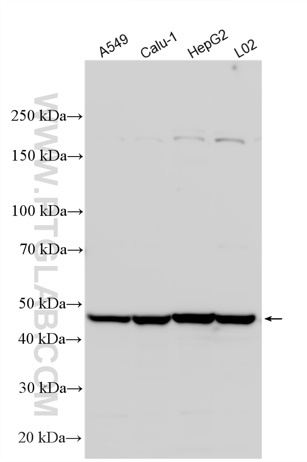 Western Blot (WB) analysis of various lysates using ZIP7 Polyclonal antibody (19429-1-AP)